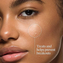Neutrogena Oil-Free Acne Face Wash, Fragrance Free, Sensitive Skin Facial Cleanser with 2% Salicylic Acid Acne Treatment for Face, 9.1 Fl Oz